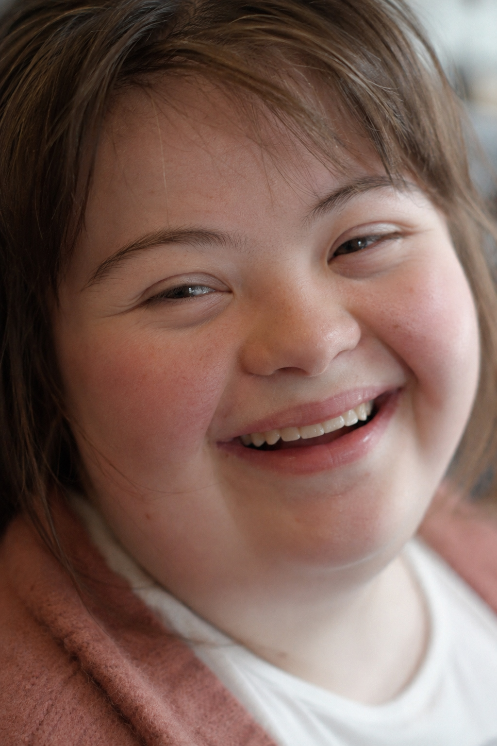 Downsyndroom